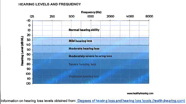 GN1698 Hearing levels graph